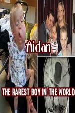 Watch Aidan The Rarest Boy In The World Afdah
