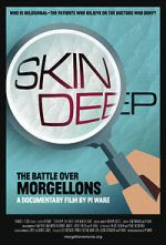 Watch Skin Deep: The Battle Over Morgellons Afdah