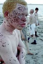 Watch Albino United Afdah
