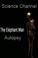 Watch Science Channel Elephant Man Autopsy Afdah