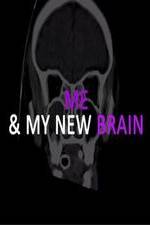 Watch Me & My New Brain Afdah