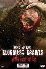Watch TNA Wrestling: Best of the Bloodiest Brawls - Scars and Stitches Afdah
