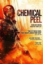 Watch Chemical Peel Afdah