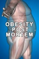 Watch Obesity: The Post Mortem Afdah