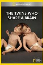 Watch National Geographic The Twins Who Share A Brain Afdah