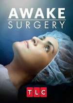 Watch Awake Surgery Afdah